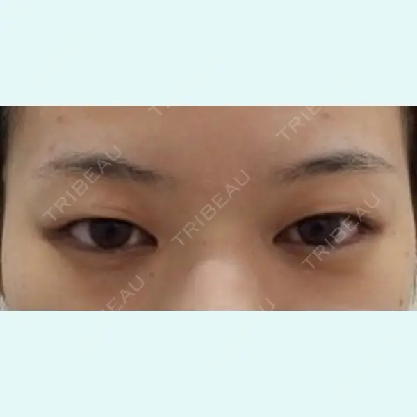 ユウコ形成外科クリニック 植田　有子医師の症例