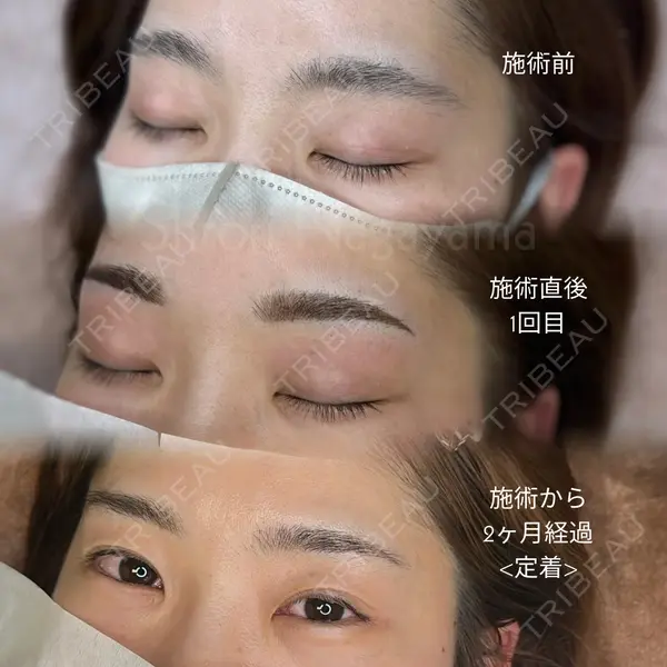 M'sクリニック【エムズクリニック】 永山　詩織（アートメイク施術者）医師の症例