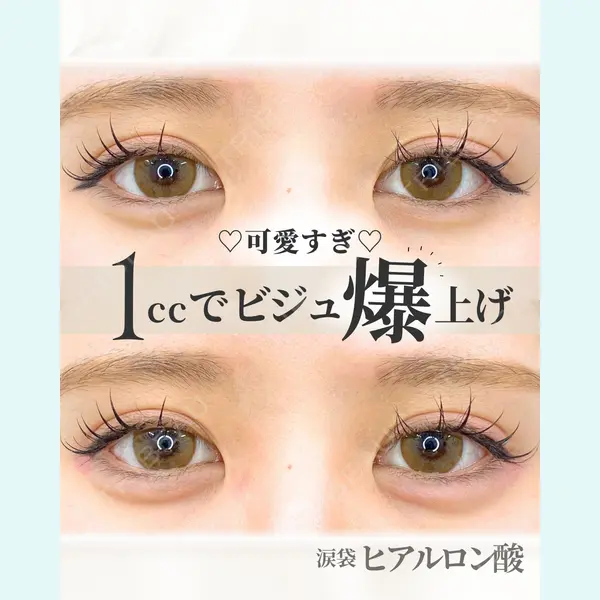 APスキンクリニック銀座 高麗 惠理医師の症例