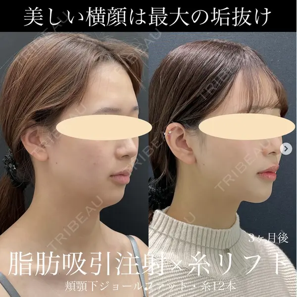 湘南美容クリニック 名古屋駅本院 豊嶋 沙良医師の症例