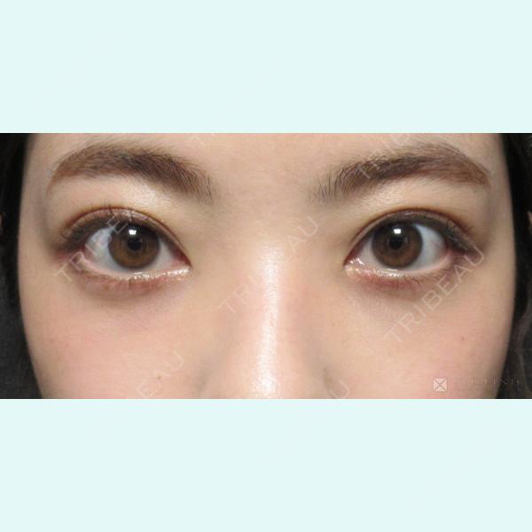 X CLINIC 恵比寿院 孫 駿一郎医師の症例