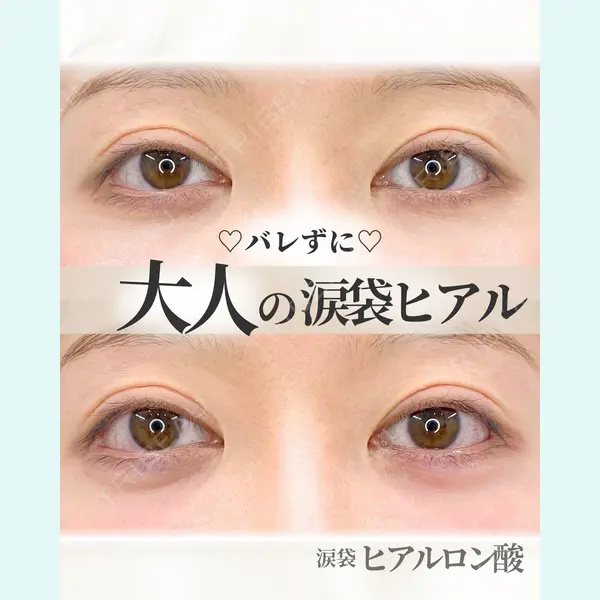 APスキンクリニック銀座 高麗 惠理医師の症例