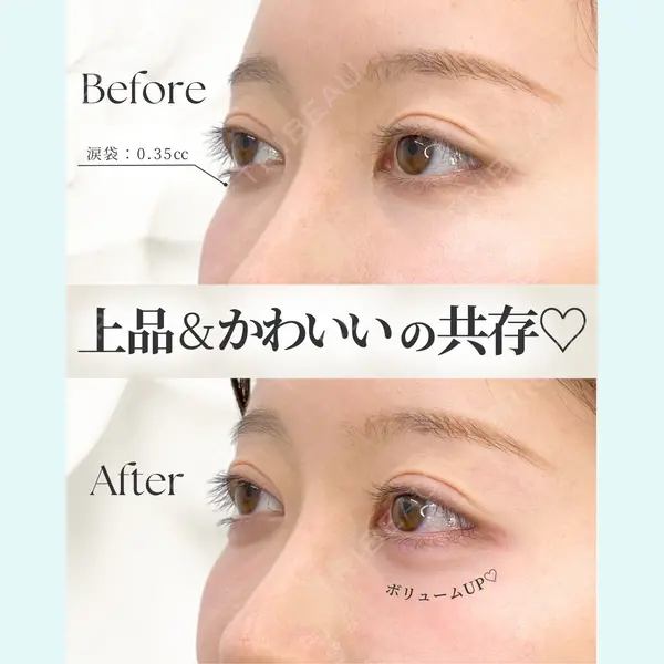 APスキンクリニック銀座 高麗 惠理医師の症例