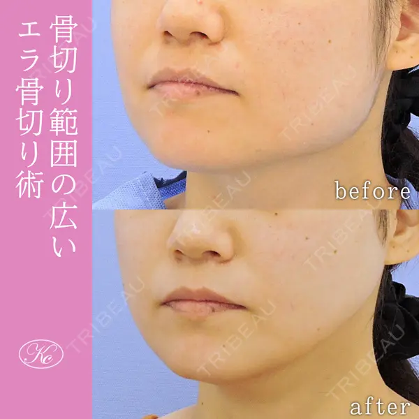 小木曽クリニック 小木曽 祐一医師の症例