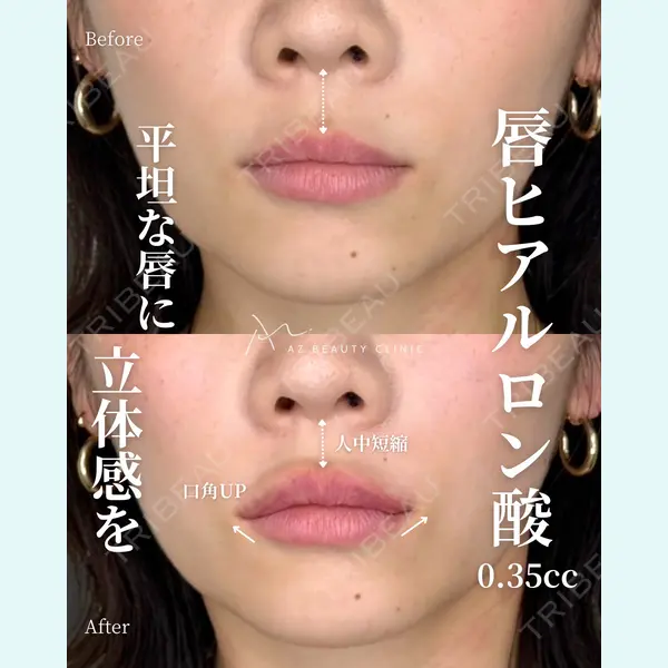 AZ BEAUTY CLINIC 木村 潤医師の症例