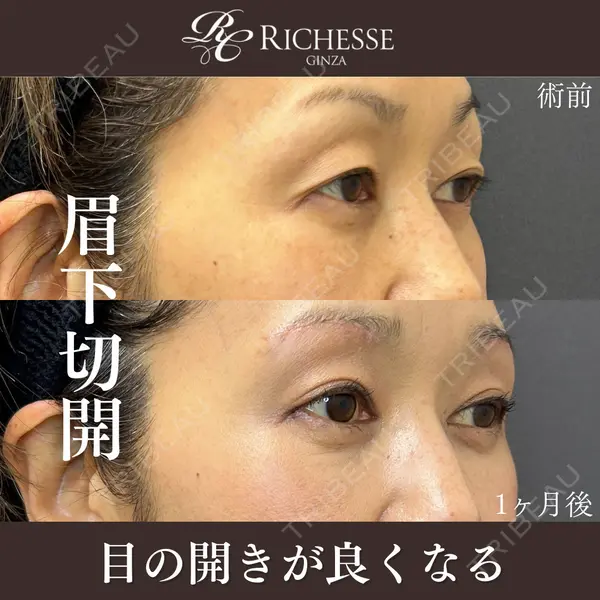 銀座リシェスクリニック 平岡 美樹子医師の症例