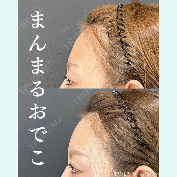 Tokyo Tensei Clinic 銀座院 宮田康生医師の症例