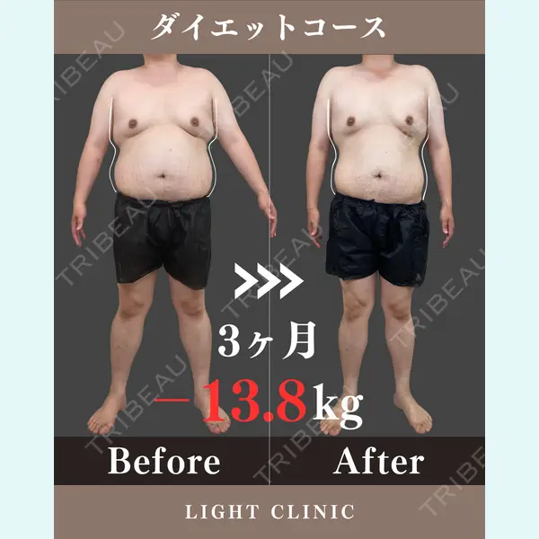 LIGHT CLINIC 【ライトクリニック】 新宿院の症例