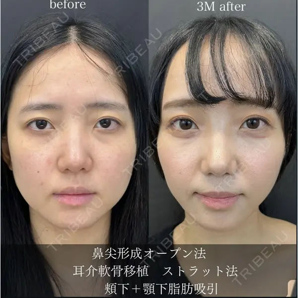 ルラ美容クリニック 静岡院の症例