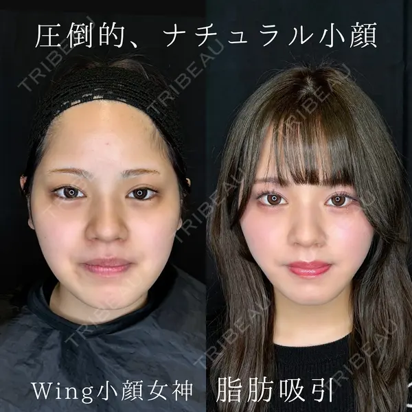 Wing clinic 豊中駅前院 速水 翼医師の症例