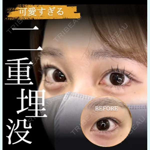 ルラ美容クリニック 高田馬場院 若佐 卓矢医師の症例