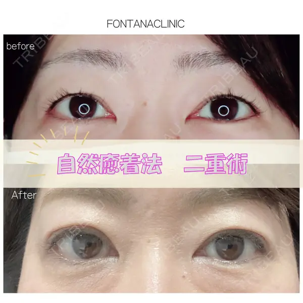 フォンタナクリニック天神 松本 かな子医師の症例