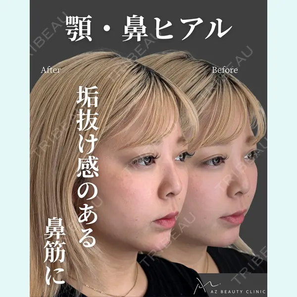 AZ BEAUTY CLINIC 木村 潤医師の症例