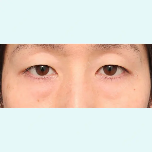 プリモ麻布十番クリニック 大場教弘医師の症例