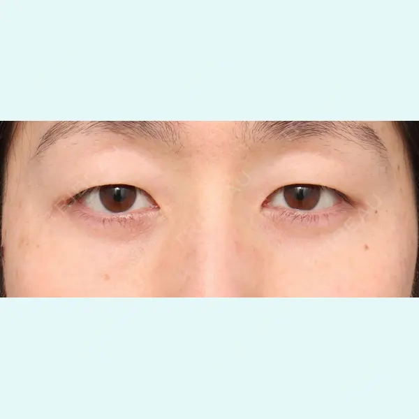 プリモ麻布十番クリニック 大場教弘医師の症例