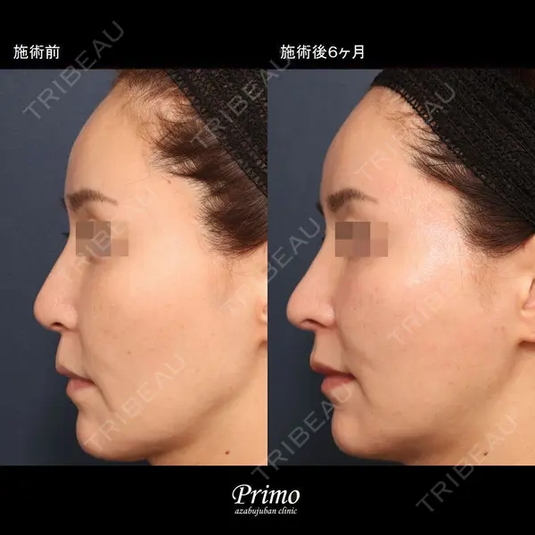 プリモ麻布十番クリニック 大場教弘医師の症例
