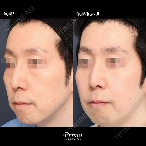 プリモ麻布十番クリニック 大場教弘医師の症例