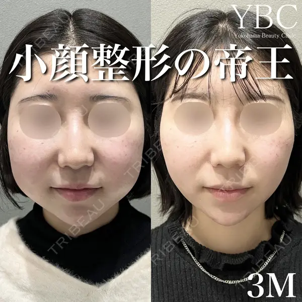 YBC横浜美容外科 大宮院 磯村 亮輔医師の症例