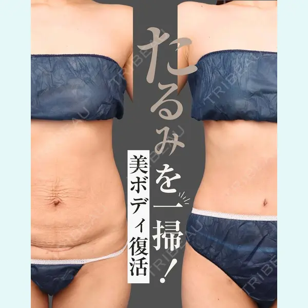 THE CLINIC（ザ・クリニック） 東京院 今西 理也医師の症例