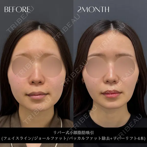 RIVER CLINIC（リバークリニック） 戸田 貴之医師の症例