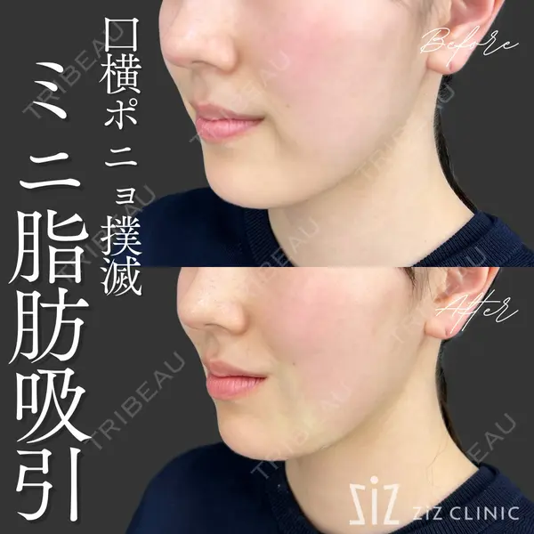 ziz CLINIC 村岡 史子医師の症例