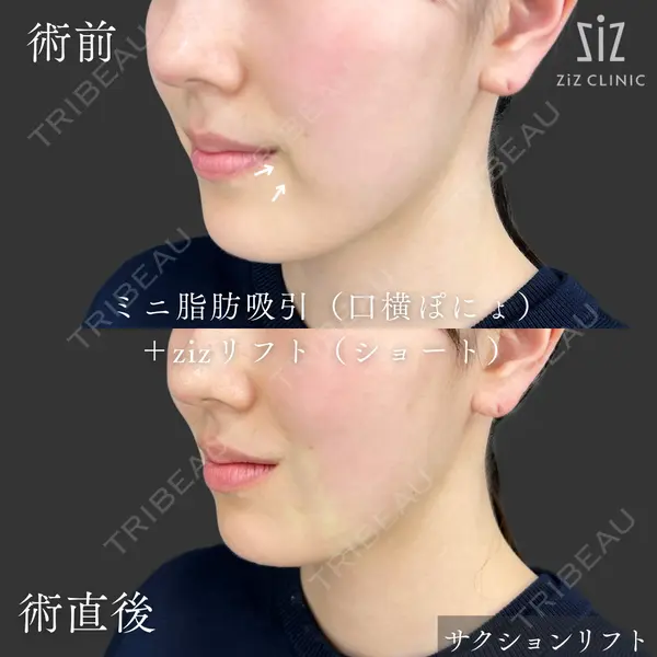 ziz CLINIC 村岡 史子医師の症例