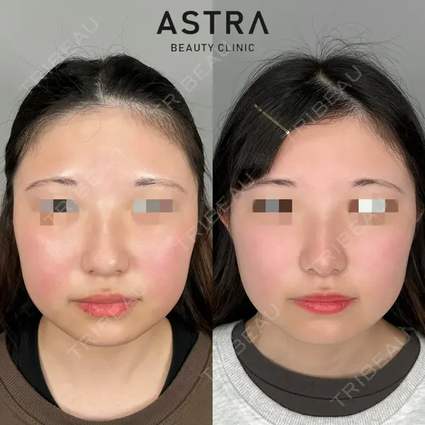 ASTRA BEAUTY CLINIC 塩満 惠子医師の症例