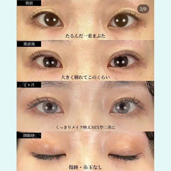 湘南美容クリニック 大阪梅田院 横谷 仁彦医師の症例