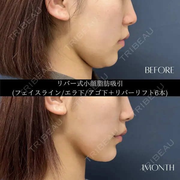 RIVER CLINIC（リバークリニック） 戸田 貴之医師の症例