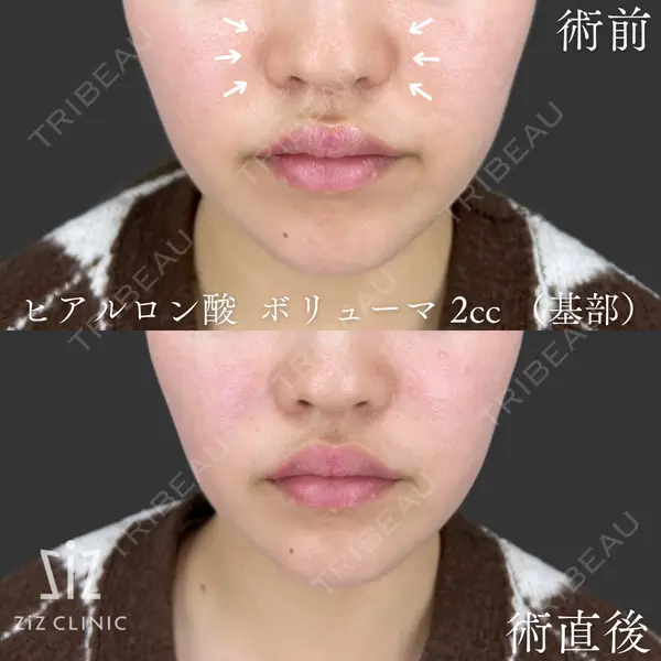ziz CLINIC 村岡 史子医師の症例