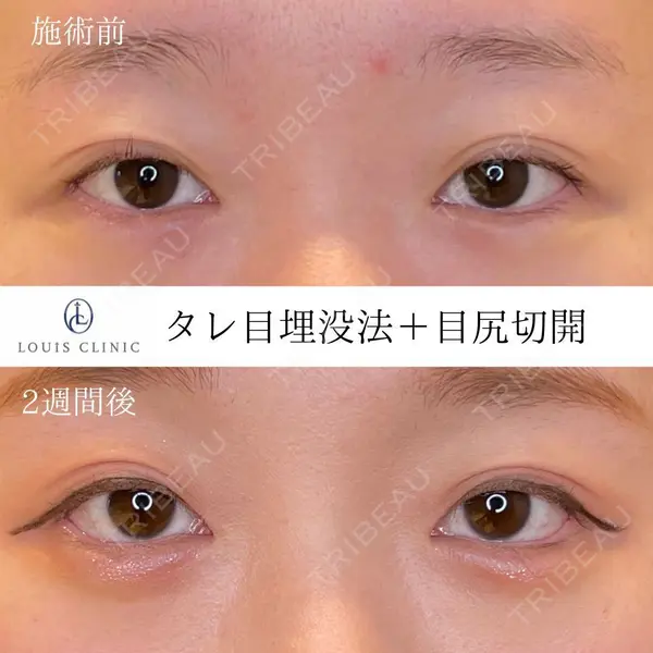 LOUIS CLINIC 二子玉川院【ルイクリニック】 小松 塁医師の症例