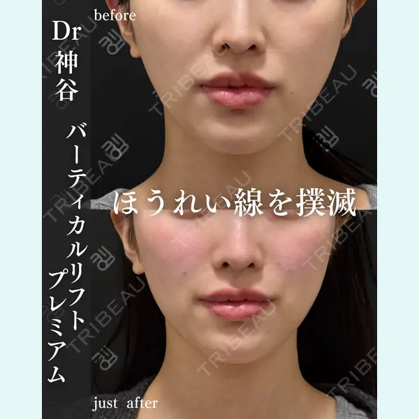EMMO FACE CLINIC 大阪梅田院 神谷 一成医師の症例