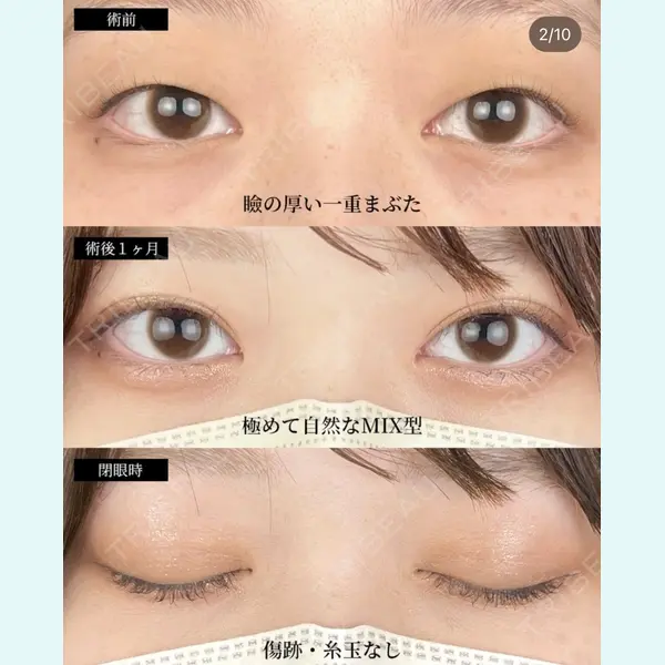 湘南美容クリニック 大阪梅田院の症例