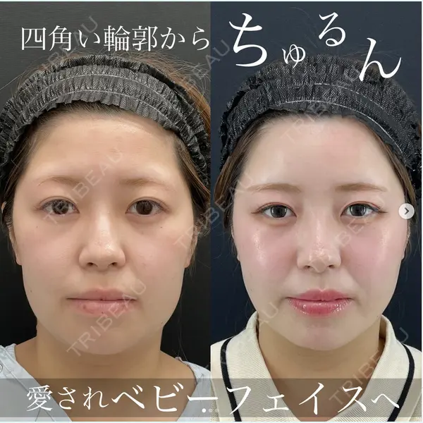 湘南美容クリニック 名古屋駅本院 豊嶋 沙良医師の症例