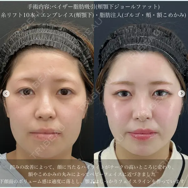 湘南美容クリニック 名古屋駅本院 豊嶋 沙良医師の症例