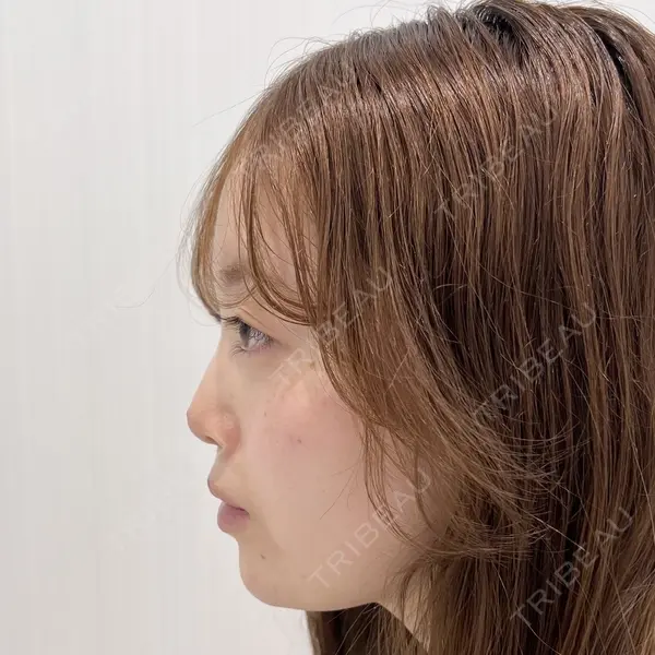 Days Beauty Clinicの症例