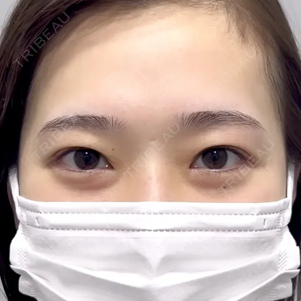 Days Beauty Clinicの症例
