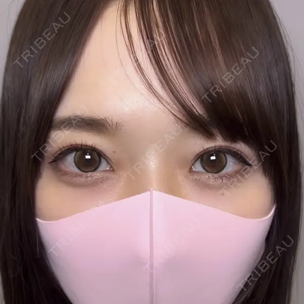 Days Beauty Clinicの症例
