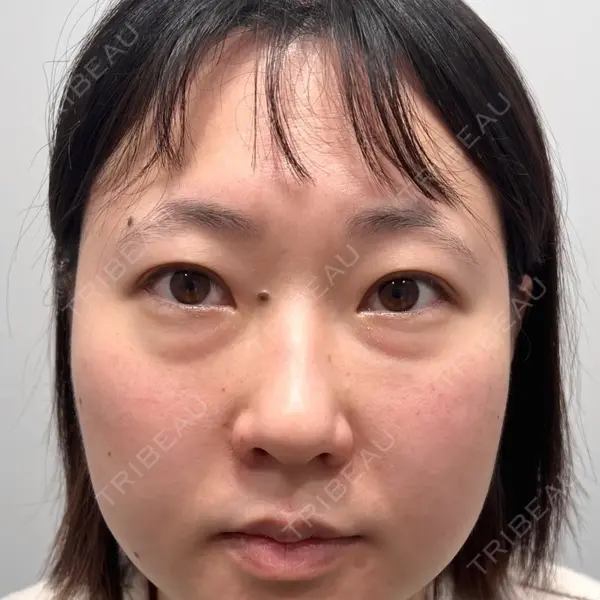 Days Beauty Clinicの症例