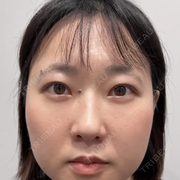 Days Beauty Clinicの症例