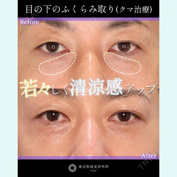 東京形成美容外科 銀座院 中尾 真紀医師の症例