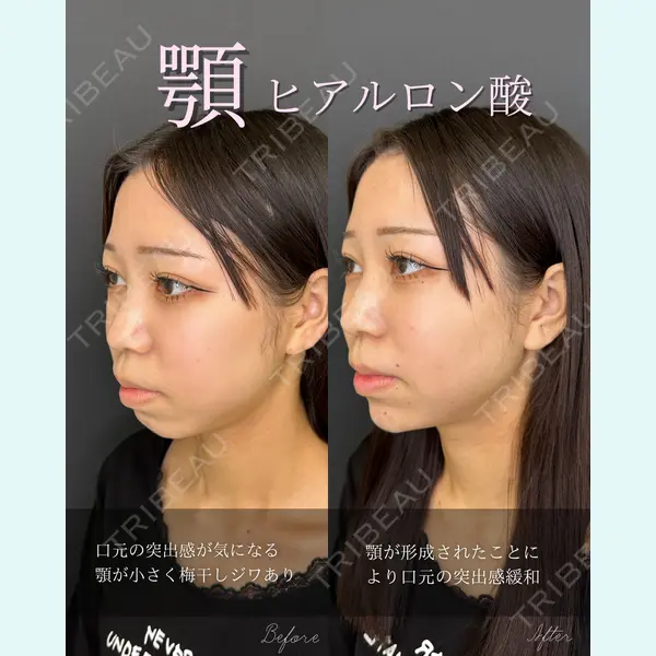 ルラ美容クリニック 大宮院 右京 大季医師の症例