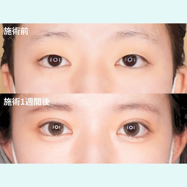 城本クリニック 郡山院 佐々木 友美子 医師の症例