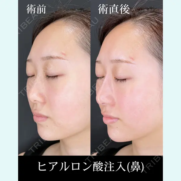 HAAB×DREAM BEAUTY CLINIC 大阪梅田院 柏木 太雅医師の症例