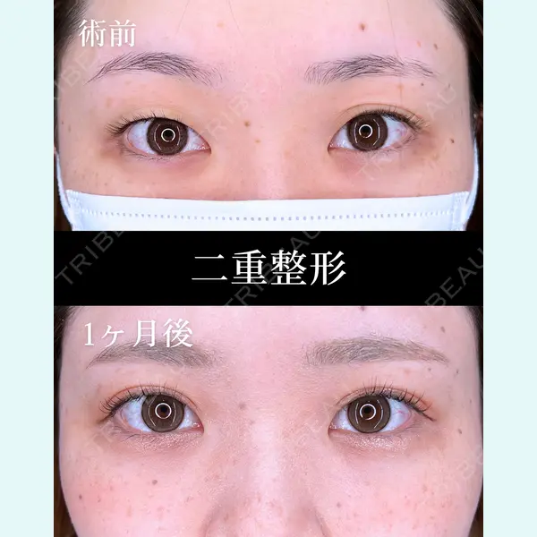 HAAB×DREAM BEAUTY CLINIC 大阪梅田院 柏木 太雅医師の症例