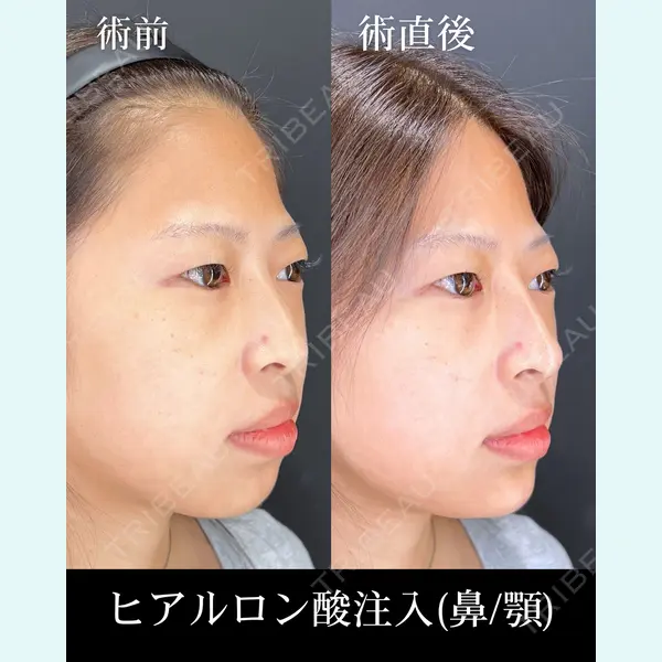 HAAB×DREAM BEAUTY CLINIC 大阪梅田院 柏木 太雅医師の症例