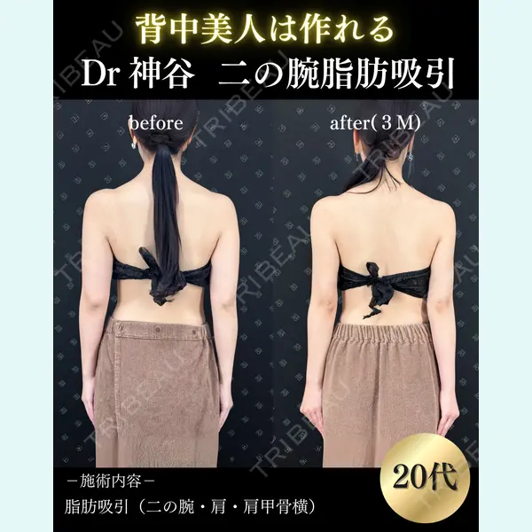 EMMO FACE CLINIC 大阪梅田院 神谷 一成医師の症例