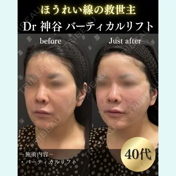 EMMO FACE CLINIC 大阪梅田院 神谷 一成医師の症例
