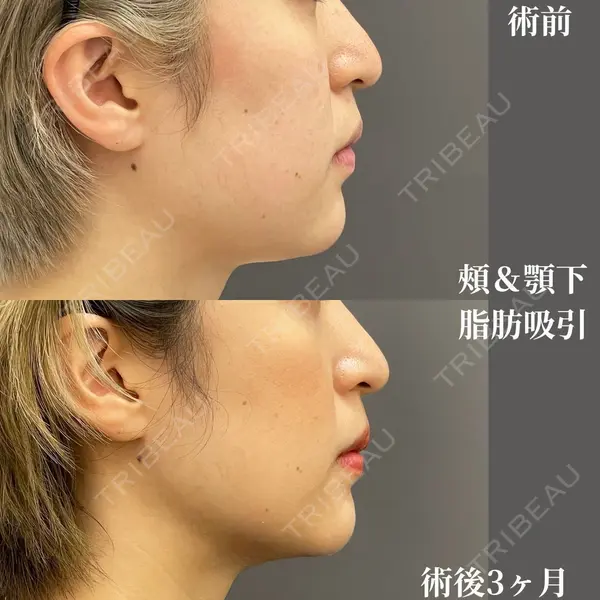 お茶の水美容形成クリニックの症例