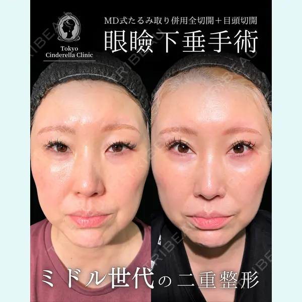 東京シンデレラ美容外科 大宮院 竹田 昌平医師の症例